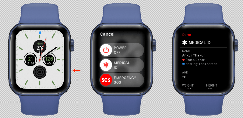 如何在 iPhone 和 Apple Watch 上设置您的医疗 ID 如何 第3张